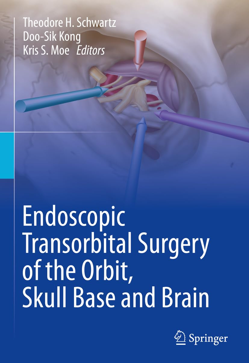 Buy Endoscopic Transorbital Surgery of the Orbit, Skull Base and